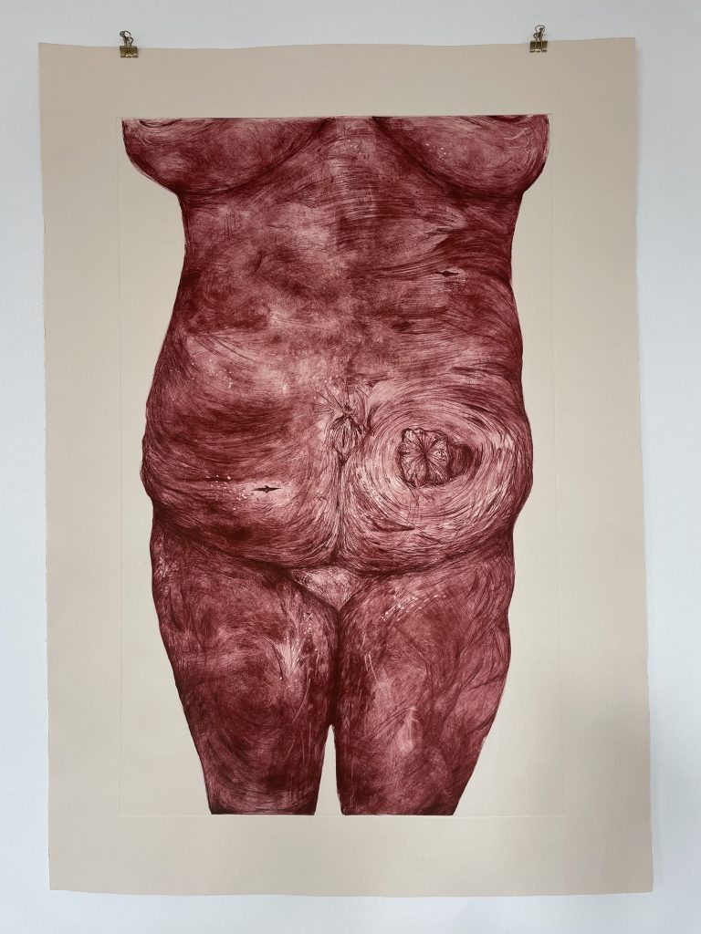 BA Fine Artwork by Poppy Cahill, showing a bold red body using DryPoint , exposing her stoma.